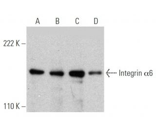 Integrin &alpha;6/ITGA6/CD49f Antibody (541A11) - Western Blotting - Image 363290Each CRISPR/Cas9 Knockout (KO) Plasmid product consists of a pool of 3 plasmids designed to ensure identification and cleavage of a specific gene for maximum knockout efficiency. Each plasmid encodes a unique 20 nt sequence derived from the GeCKO (v2) library. 