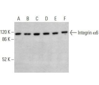 Integrin α6/ITGA6/CD49f Antibody (2Q959) - Western Blotting - Image 355267