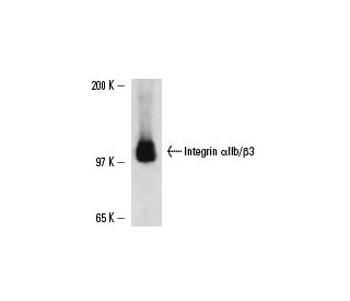Integrin &alpha;IIb/&beta;3/CD41/CD61 Antibody (474) - Western Blotting - Image 14857