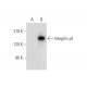 western blotting image from recommended Integrin αX/ITGAX/CD11c (D-8) monoclonal antibody replacement. Image 308118