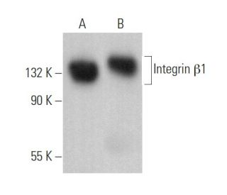 Integrin &beta;1/ITGB1 Antibody (3H1192) - Western Blotting - Image 375026 