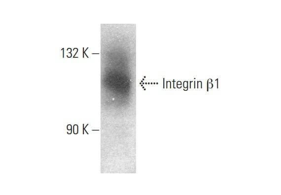 Integrin β1/ITGB1 Antibody (A-4) | SCBT - Santa Cruz Biotechnology