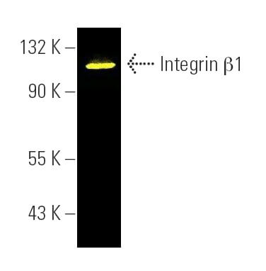 Integrin β1/ITGB1 Antibody (JB1B) | SCBT - Santa Cruz Biotechnology