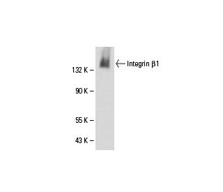 Integrin &beta;1/ITGB1 Antibody (TS2/16) - Western Blotting - Image 18091 