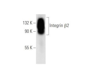 Integrin &beta;2 Antibody (6A21) - Western Blotting - Image 62625