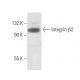 Integrin β2/ITGB2/CD18 Antibody (6G2) - Western Blotting - Image 15484