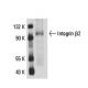 Integrin β2/ITGB2/CD18 Antibody (M18/2) - Western Blotting - Image 18080 