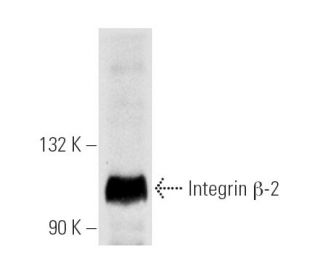 western blotting image from recommended Integrin β2/ITGB2/CD18 (CTB104) monoclonal antibody replacement. Image 5238