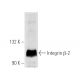 western blotting image from recommended Integrin β2/ITGB2/CD18 (CTB104) monoclonal antibody replacement. Image 5238