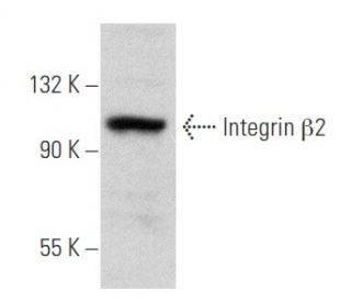 Integrin &beta;2 Antibody (P4H9) - Western Blotting - Image 354818 