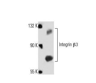 Integrin &beta;3/ITGB3/CD61 Antibody (5K291) - Western Blotting - Image 158565 