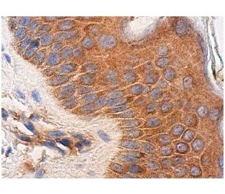 Integrin &beta;3/ITGB3/CD61 Antibody (BV4) - Immunohistochemistry - Image 282270 