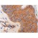 Integrin β3/ITGB3/CD61 Antibody (BV4) - Immunohistochemistry - Image 282270 