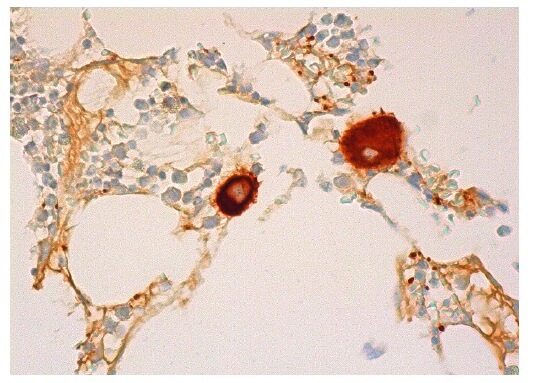 キムキム様 integrin-beta3-antibody-d-11-