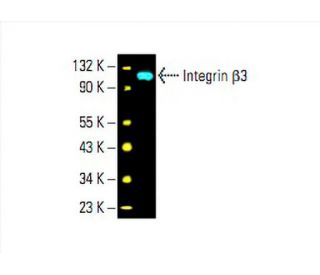 キムキム様 Integrin β3/ITGB3/CD61 Antibody (D-11) | SCBT - Santa Cruz