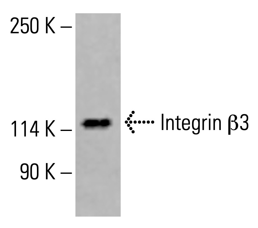 Integrin β3/ITGB3/CD61 Antibody (D-11) | SCBT - Santa Cruz