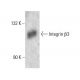 Integrin β3/ITGB3/CD61 Antibody (NaM28-7D6) - Western Blotting - Image 14040 