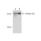 This polyclonal antibody has been discontinued. See our recommended <a href="integrin-beta4-antibody-b-7">Integrin β4/ITGB4/CD104 (B-7)</a> monoclonal antibody (sample data shown). western blotting image from recommended Integrin β4/ITGB4/CD104 (B-7) monoclonal antibody replacement. Image 319274