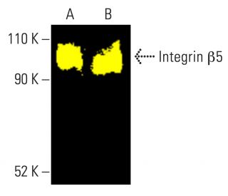 Integrin β5/ITGB5 Antibody (F-5) | SCBT - Santa Cruz Biotechnology