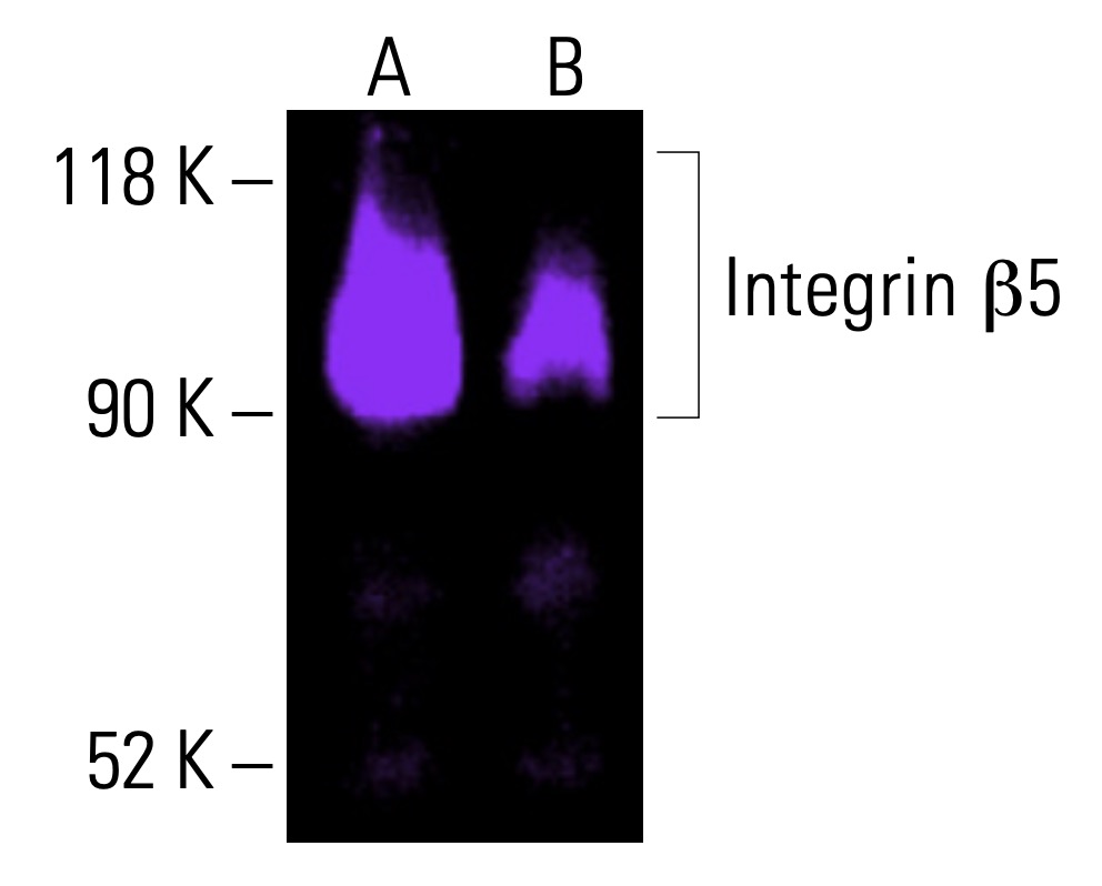 なんとかβ 様専門 Integrin β5/ITGB5 Antibody (F-5) | SCBT - Santa Cruz Biotechnology