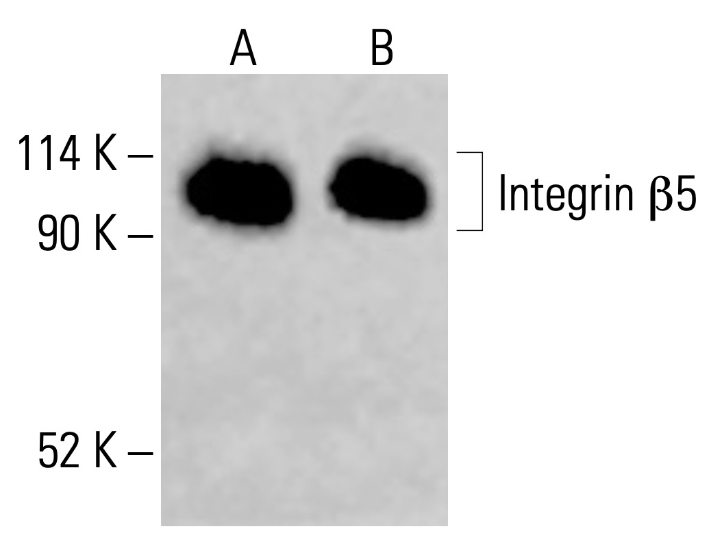 Integrin β5/ITGB5 Antibody (F-5) | SCBT - Santa Cruz Biotechnology