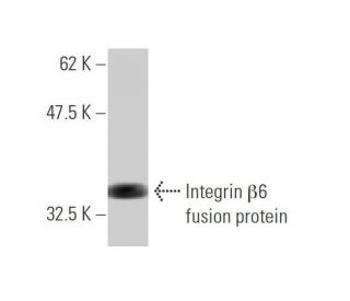 western blotting image from recommended Integrin &beta;6/ITGB6 (4C3) monoclonal antibody replacement. Image 348526