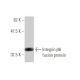 western blotting image from recommended Integrin β6/ITGB6 (4C3) monoclonal antibody replacement. Image 348526