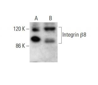 western blotting image from recommended Integrin &beta;8/ITGB8 (E-6) monoclonal antibody replacement. Image 382858