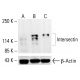 Intersectin Antibody (29) - Western Blotting - Image 412859