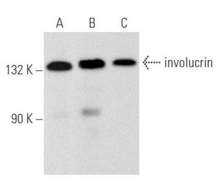 involucrin Antibody (A-5) - Western Blotting - Image 354687 