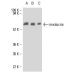 western blotting image from recommended involucrin (SY5) monoclonal antibody replacement. Image 9111
