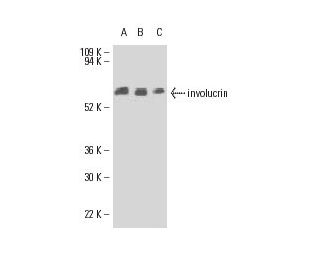 western blotting image from recommended involucrin (SY5) monoclonal antibody replacement. Image 9111