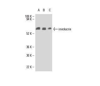 involucrin Antibody (SY5) - Western Blotting - Image 9111 