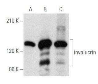 involucrin Antibody (SY8) - Western Blotting - Image 354732 