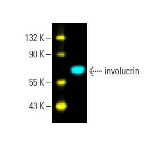 involucrin Antibody (SY5) - Western Blotting - Image 396293 
