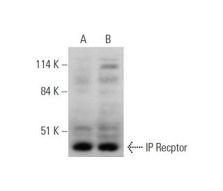 IP Receptor Antibody (B-6) - Western Blotting - Image 344258 