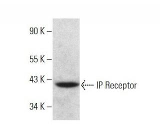IP Receptor Antibody (B-6) - Western Blotting - Image 351860Each CRISPR/Cas9 Knockout (KO) Plasmid product consists of a pool of 3 plasmids designed to ensure identification and cleavage of a specific gene for maximum knockout efficiency. Each plasmid encodes a unique 20 nt sequence derived from the GeCKO (v2) library. 