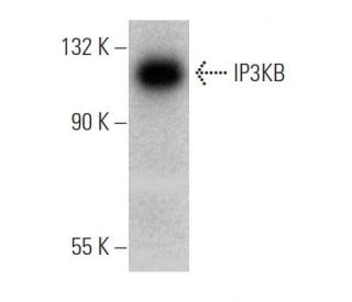 IP3KB Antibody (J-15) - Western Blotting - Image 368229 