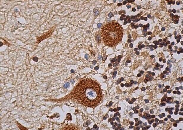 IP3R-I Antibody (E-8) | SCBT - Santa Cruz Biotechnology