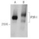 western blotting image from recommended IP3R-I (E-8) monoclonal antibody replacement. Image 361087