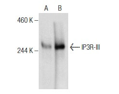 Anti-IP3R-I/II/III Antibody (B-2) | SCBT - Santa Cruz Biotechnology