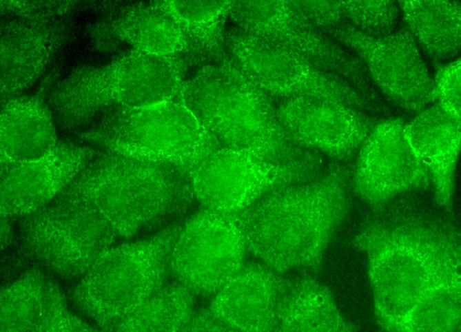 ヒマワリ様 ヒマワリ様 IP3R-II (A-5) Antibody sc-398434 from Santa Cruz