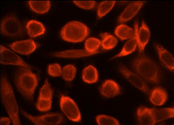 IP3R-I/II/III Antibody (B-2) | SCBT - Santa Cruz Biotechnology