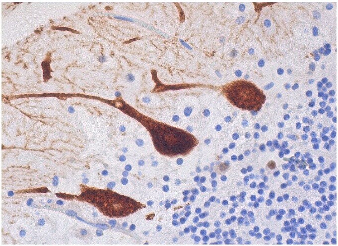IP3R-I/II/III Antibody (B-2) | SCBT - Santa Cruz Biotechnology