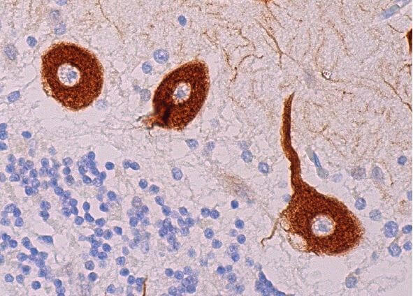 IP3R-I/II/III Antibody (B-2) | SCBT - Santa Cruz Biotechnology