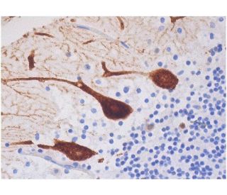 immunohistochemistry image from recommended IP3R-I/II/III (B-2) monoclonal antibody replacement. Image 286532