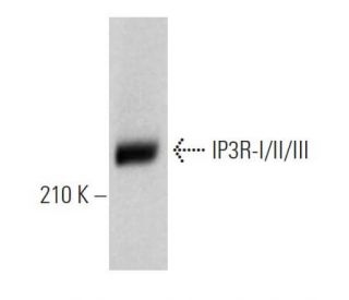 IP3R-I/II/III Antibody (B-2) - Western Blotting - Image 361086