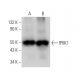 IP6K1 Antibody (E-11) - Western Blotting - Image 374838 
