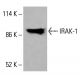 IRAK-1 Antibody (B-8) - Western Blotting - Image 416027