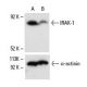 이 다클론 항체는 생산이 중단되었습니다. 권장 <a href="irak-1-antibody-f-4">IRAK-1 (F-4)</a> 단클론 항체(샘플 데이터 표시)를 참조하세요. western blotting image from recommended IRAK-1 (F-4) monoclonal antibody replacement. Image 6849